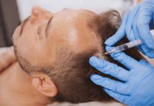 Hair Transplant: The Permanent Solution for Hair Loss at TrichoHom in Ahmedabad hair transplant