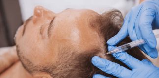 Hair Transplant: The Permanent Solution for Hair Loss at TrichoHom in Ahmedabad hair transplant